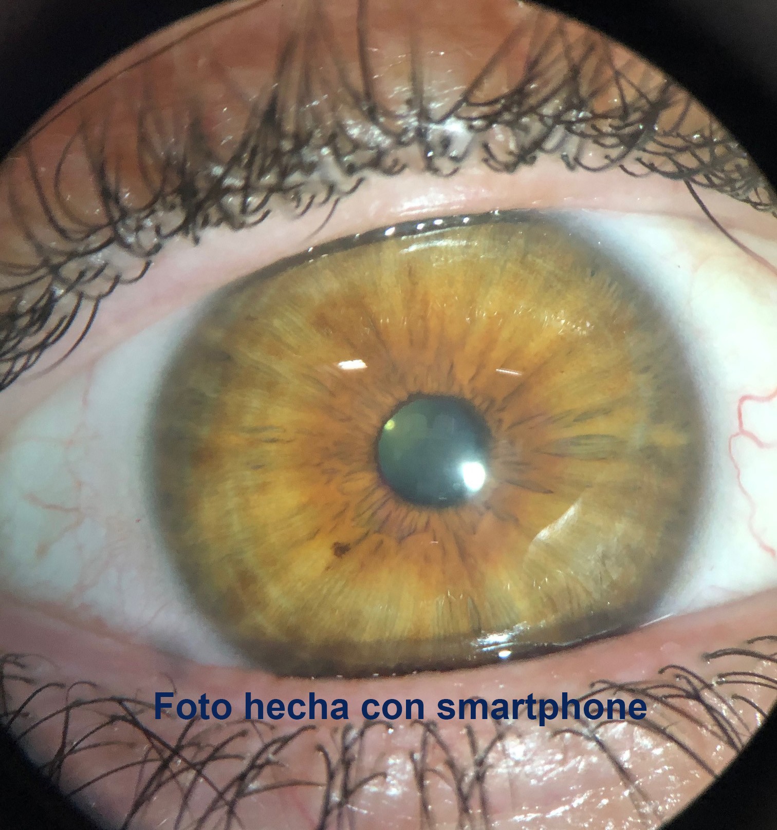 IRISCOPIO ESTEROSCÓPICO CON MENTONERA - Imagen 5