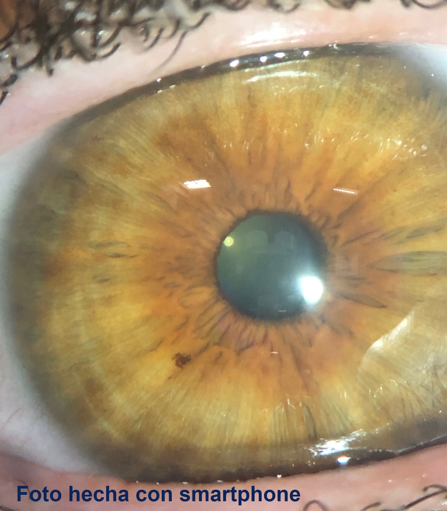 IRISCOPIO ESTEROSCÓPICO CON MENTONERA - Imagen 6