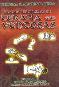 TRATADO ILUSTRADO DE TERAPIA CON VENTOSAS